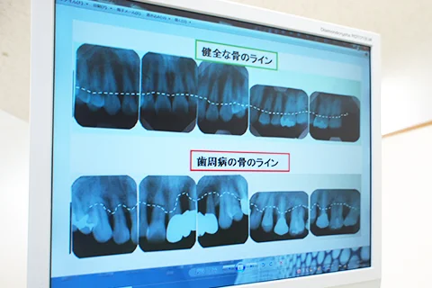 モニター設備