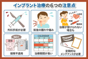 どんなデメリットがある？ インプラント治療前に知っておきたいこと