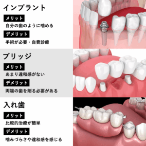 歯がないデメリットを補うためのインプラント