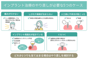 インプラント治療後のメンテナンスが重要な理由とは？長持ちさせるためのポイント