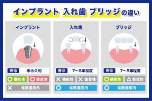 歯が抜けたらブリッジとインプラントどちらを選ぶ？特徴や治療内容を比較